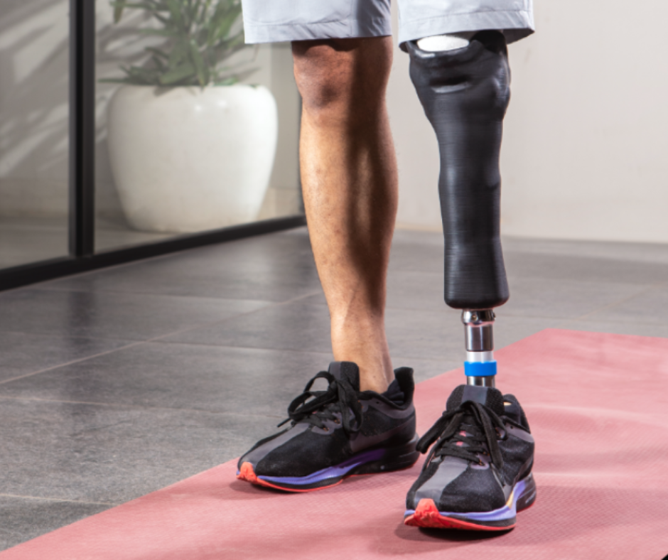 Lower Limb Amputee Screening & Rehab